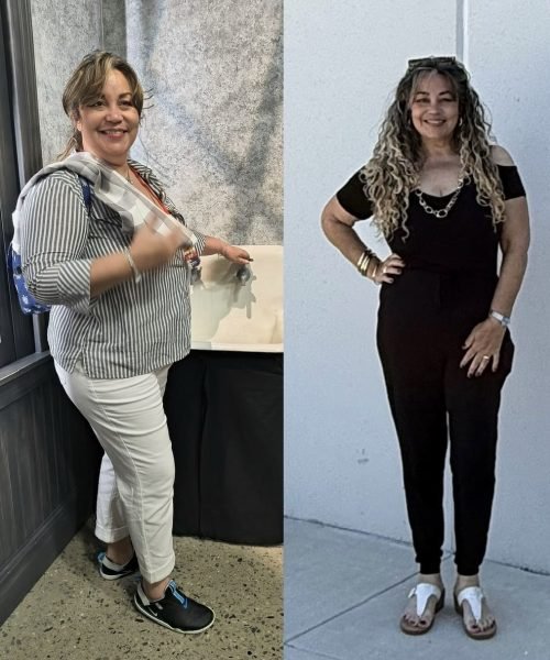 Before and after photos of a patient showing wellness progress (2)