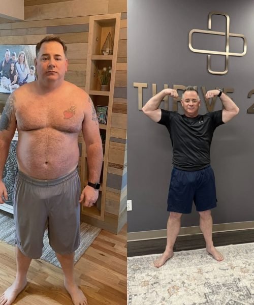 Before and after photos of a patient showing wellness progress (3)