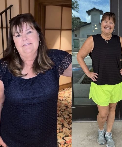 Before and after photos of a patient showing wellness progress (09)