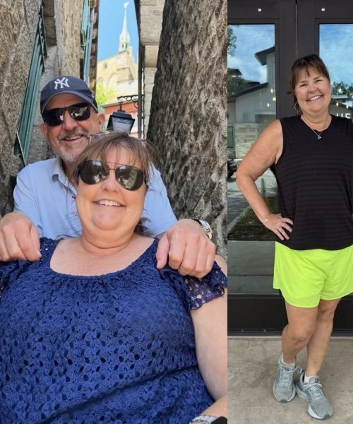 Before and after photos of a patient showing wellness progress (04)