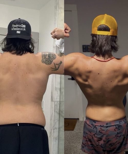 Before and after photos of a patient showing wellness progress (06)