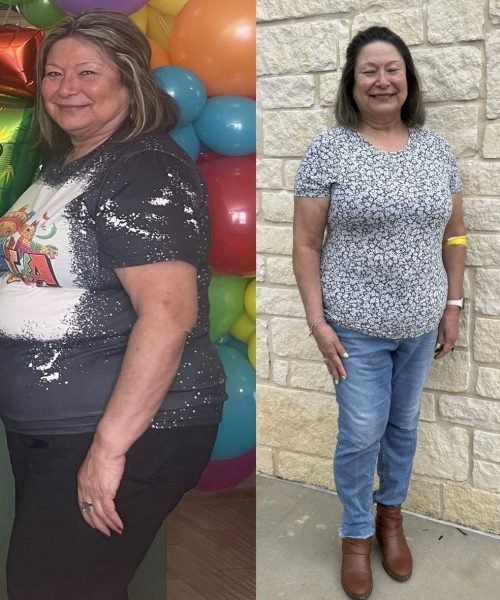 Before and after photos of a patient showing wellness progress (08)